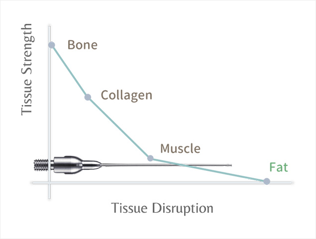 Compared to traditional liposuction techniques, LSSA offers several unique advantages.